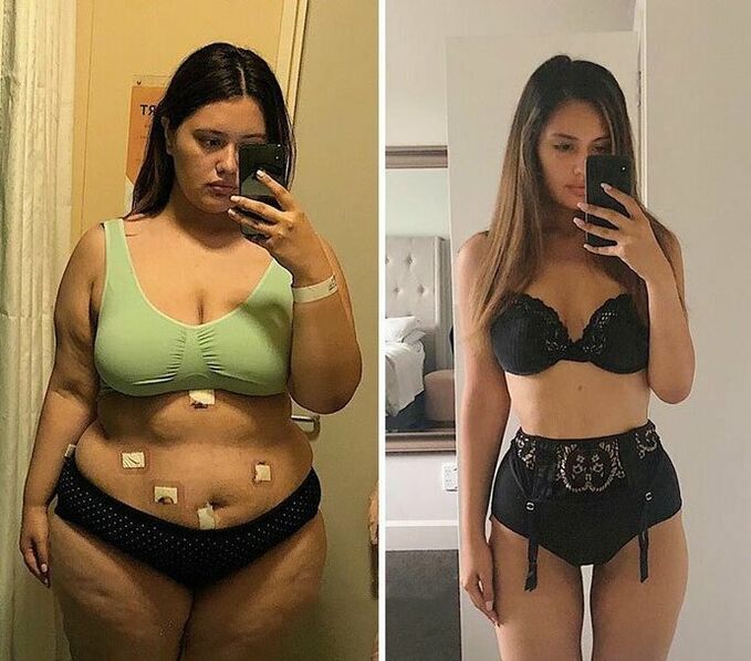 Girl capsule KETO Complete before and after weight loss